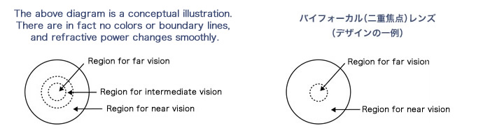 ブログレッシブ(累進屈折力)